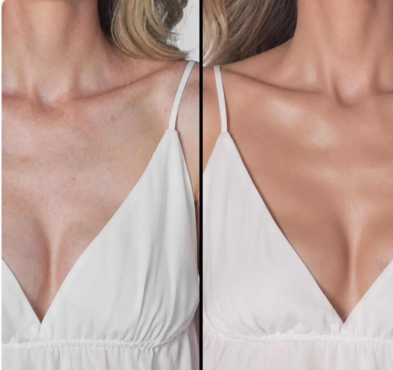 Before and after using Monserae Flawless Body Perfector — Chest & Décolletage