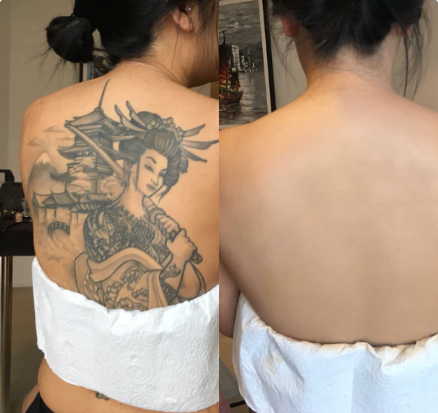 Before and after using Monserae Flawless Body Perfector — Tattoo Coverage