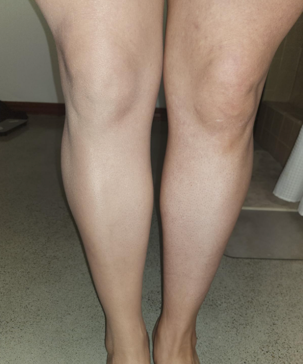 Lauren, Monserae customer